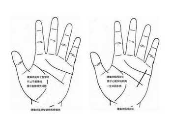 从手相健康线看你的健康状况