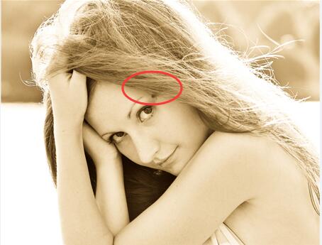 眼睛上方的痣叫什么 2017814101856328.jpg